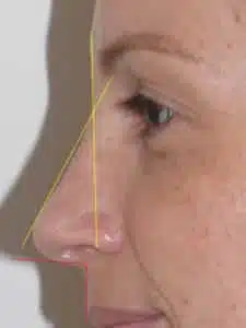anatomie artistique du nez