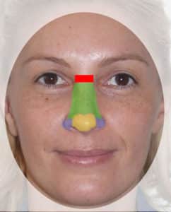 sous-unités du nez pour reconstruction du nez