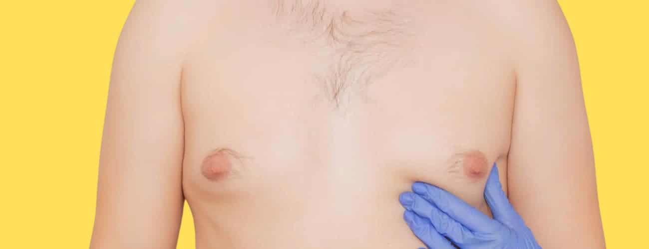 photos chirurgie esthetique gynecomastie