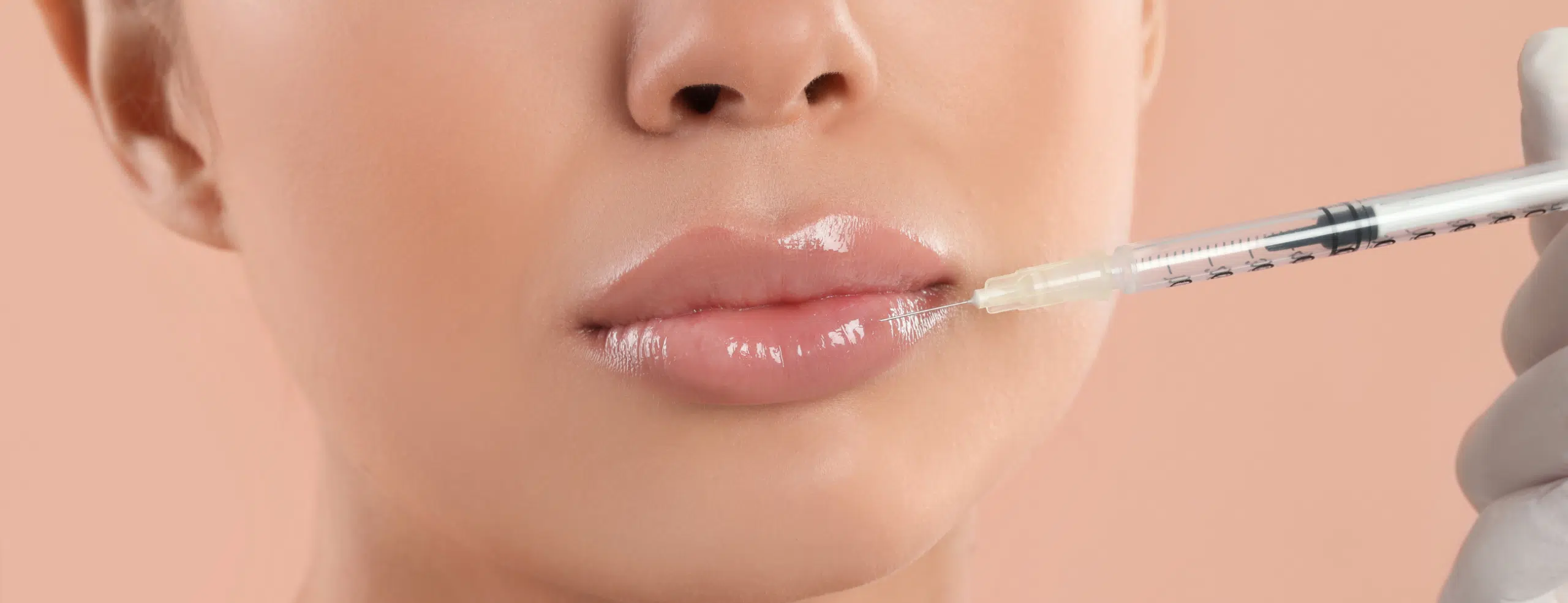 Lèvres trop fines : des traitements efficaces