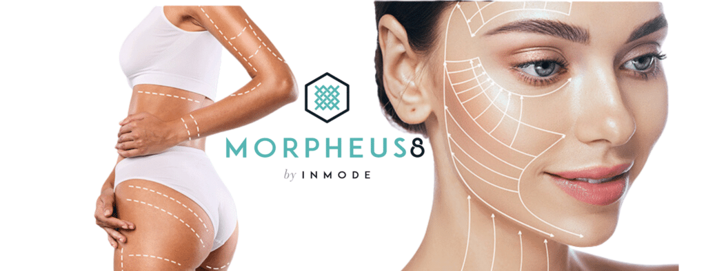 morpheus 8